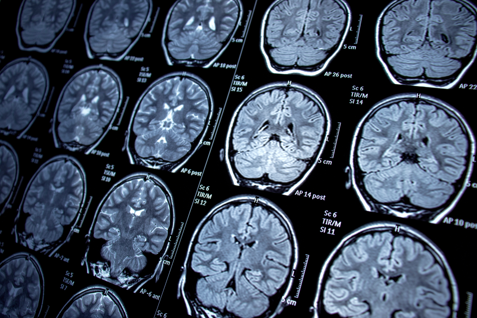 8 Reasons to Move Your Clinical Trial Imaging to TrialKit Right Now