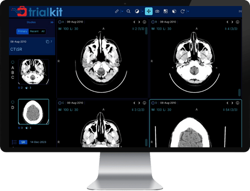 TrialKit AI image recognition